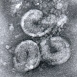 Horse torovirus