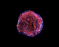 Restu de la supernova Tycho Supernova vista con rayos X