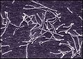 Thermus aquaticus (Deinococcus-Thermus)