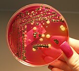 A culture of salmonella bacteria