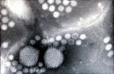 Electron micrograph of adenovirus and adeno-associated virus