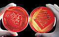 Red blood cells on agar plates