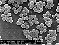 Staphylococcus aureus (Firmicutes)
