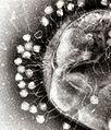 Image 4Foto sejumlah bakteriofag yang menempel pada dinding sel bakteri dalam mikroskop transmisi elektron. Oleh: Dr Graham Beards. (from Portal:Virus/Gambar pilihan)