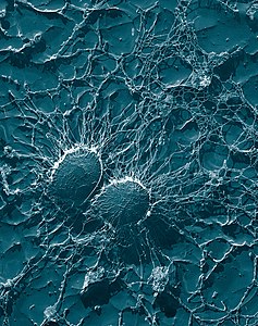 凍結乾燥された黄色ブドウ球菌 (Staphylococcus aureus) のレプリカ。透過型電子顕微鏡により撮影。 作者：Eric Erbe, Christopher Pooley