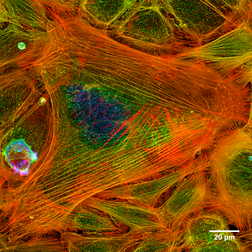 Imagem construída por microscopia confocal mostrando filamentos de actina no interior de uma célula. (definição 4 096 × 4 096)