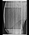 Imagen digital filtros radiodiagnóstico