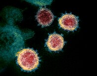 Hình ảnh hiển vi điện tử truyền qua của virus SARS-CoV-2 gây bệnh COVID-19