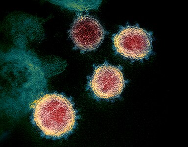 ภาพทางจุลทรรศนศาสตร์แสดง SARS-CoV-2 โดยมี spikes บนขอบด้านนอกของอนุภาคไวรัสที่มีลักษณะคล้ายมงกุฎ อันเป็นที่มาของชื่อในภาษาอังกฤษ