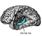 Người có hai hồi hải mã nằm ở hai bên bán cầu não. Hồi hải mã nằm ở thùy thái dương trong của não. Ở vị trí quan sát từ phía ngoài não, thùy trán ở bên trái, thùy chẩm ở bên phải và thùy thái dương, thùy đỉnh được cắt bỏ phần lớn để quan sát được hồi hải mã nằm ẩn ở phía dưới.