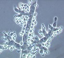 Trichoderma fertile thuộc Ascomycota