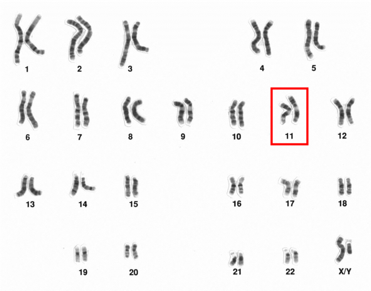 File:Human male karyotpe high resolution - Chromosome 11.png