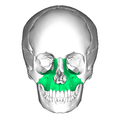 頭顱。上頜骨的位置(顯示為綠色)。