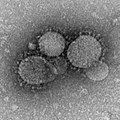 متلازمة الشرق الأوسط التنفسية-فيروس كورونا تحت المجهر الإلكتروني.