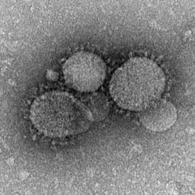 MERS-Cov-virus mikroskooppikuvassa