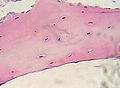 Гиалиновый хрящ, окрашенный гематоксилином и эозином, под микроскопом