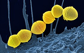 Micrografia eletrônica de varredura em cores falsas da cadeia da bactéria Streptococcus pyogenes (amarelo)