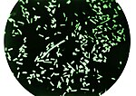 Thumbnail for File:Dark field microscopy revealing Shigella dysenteriae bacteria.jpg