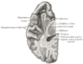 Section du cerveau montrant la surface supérieure du lobe temporal.