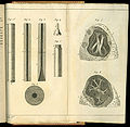 De l'auscultation médiate .... Drawings of the stethoscope and lungs.