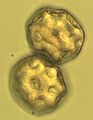 Pollenjeinek mikroszkopikus felvétele