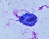 Trichomonas vaginalis May-Grünwald-Giemsa staining. A barb-like axostyle (left) projects opposite the four-flagella bundle.