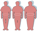 Silhuetter som viser en normal, en overvektig og en svært overvektig person.
