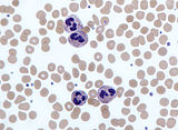 Neutrophils, a type of white blood cell