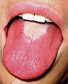 草苺舌