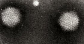 Imagem TEM do vírus Synechococcus Phage S-PM2