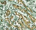 Žuto obojeni virus ptičje gripe tipa A, H5N1, u stanicama bubrega snimljen TEM-om