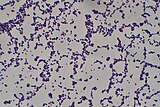Staphylococcus aureus (Gram stain