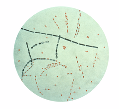Мікрофотографія Bacillus anthracis (фарбування фуксін-метиленом).
