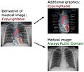 Derivative of medical imaging (Vector version available)