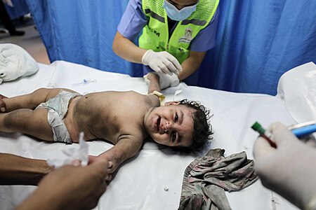 طفل فلسطيني مبتسم مصاب يعُالج في مستشفى الشفاء بغزة بعد الغارات الجوية الإسرائيلية يوم 11 أكتوبر 2023