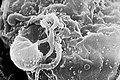 Pásztázó elektronmikroszkópos felvétel tenyésztett limfocita sejten lévő HIV-1 vírusról
