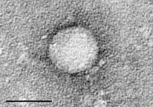 Електронний мікрознімок вірусу гепатиту C (масштаб = 50 нм)