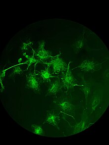 Células vistas através de um microscópio de fluorescência que permite ver uma determinada proteína em verde.