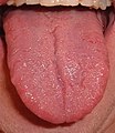 A human tongue.