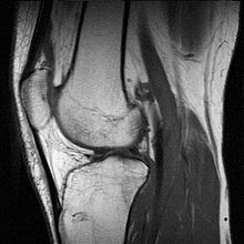 Immagine sagittale di un ginocchio ottenuta mediante risonanza magnetica