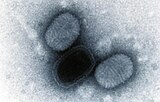 Electron micrograph of molluscum contagiosum virus