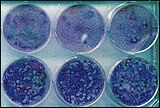The cytophathic effect of Varicella zoster virus on cells in cultures