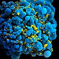 Image 1Foto sel T yang diinfeksi oleh HIV dalam mikroskop pemindai elektron. Oleh: NIAID. (from Portal:Virus/Gambar pilihan)