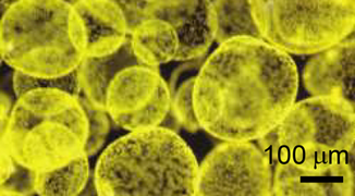 Colonies of the alga Phaeocystis antarctica, an important phytoplankter of the Ross Sea that dominates early season blooms after the sea ice retreats and exports significant carbon.[128]
