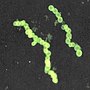 Thumbnail for File:Sulphide bacteria crop2.jpg