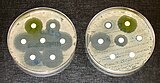 Antibiotic resistance tests: Bacteria are streaked on dishes with white disks, each impregnated with a different antibiotic.