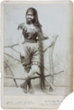 Schwarz-Weiß-Foto einer jungen Frau mit Hypertrichose. Sie lehnt an einer Art Zaun, trägt einen Vollbart und Haare, die bis zum Boden reichen