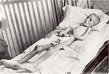 Lizzie van Zyl, uma menina bôer encarcerada pelos britânicos em um campo de concentração. Ela faleceu de febre tifoide em maio de 1901, aos 7 anos de idade.
