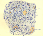 Corteccia cerebrale (caso 5, Colorazione: tionina, × 60)
