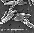 Elektronmikroskopbild av Mycobacterium tuberculosis